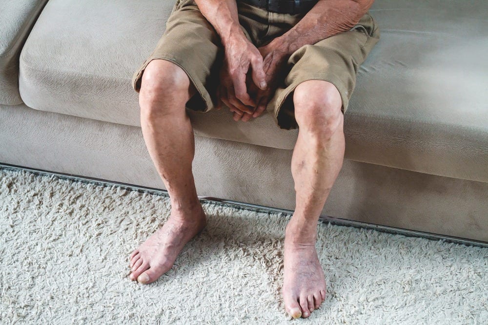 sad elderly senior sits sofa hands feet closeup